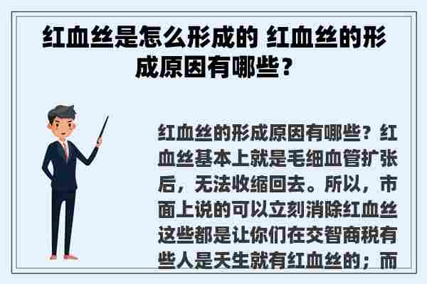 红血丝是怎么形成的 红血丝的形成原因有哪些？